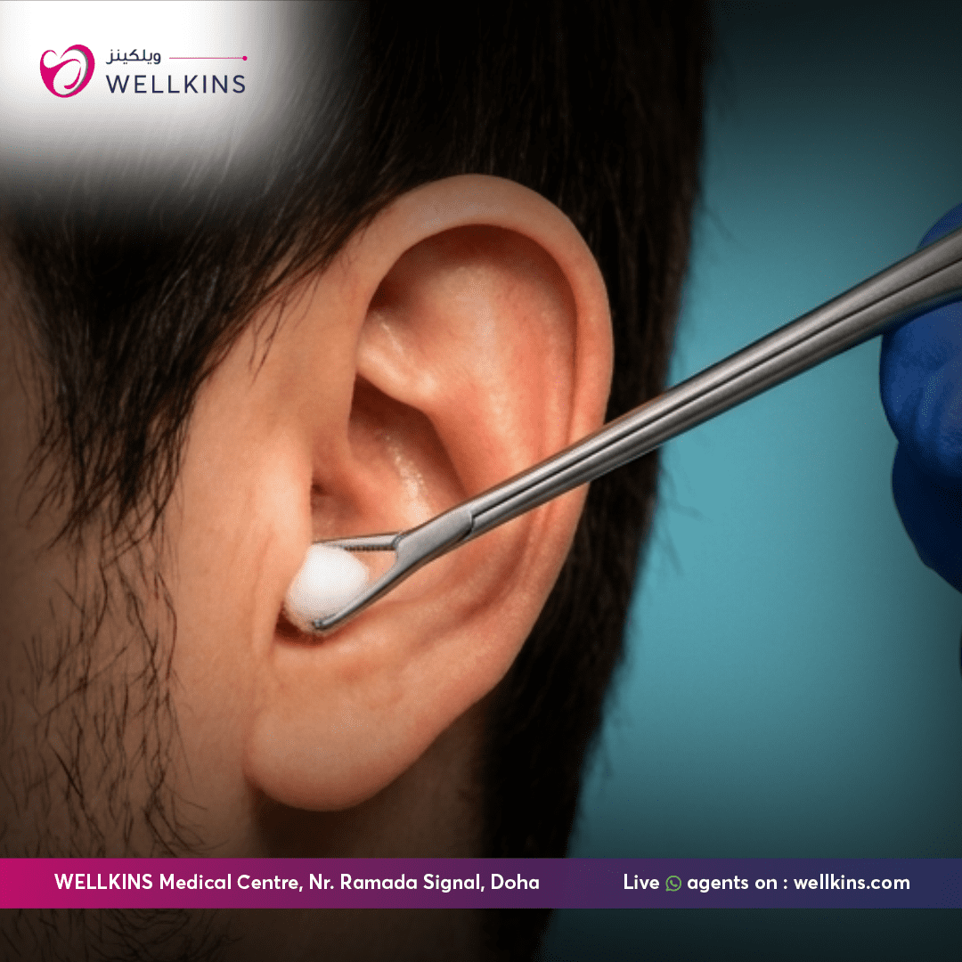 Foreign Body Removal ENT Doha Qatar - Wellkins Medical Centre